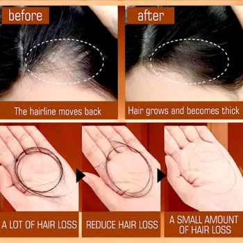 Huile Capillaire à la Batana : Le Secret pour des Cheveux Épais et Resplendissants - EELHOE – Image 2